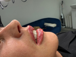 Aesthetics Banbury House Of Coco 1 Small